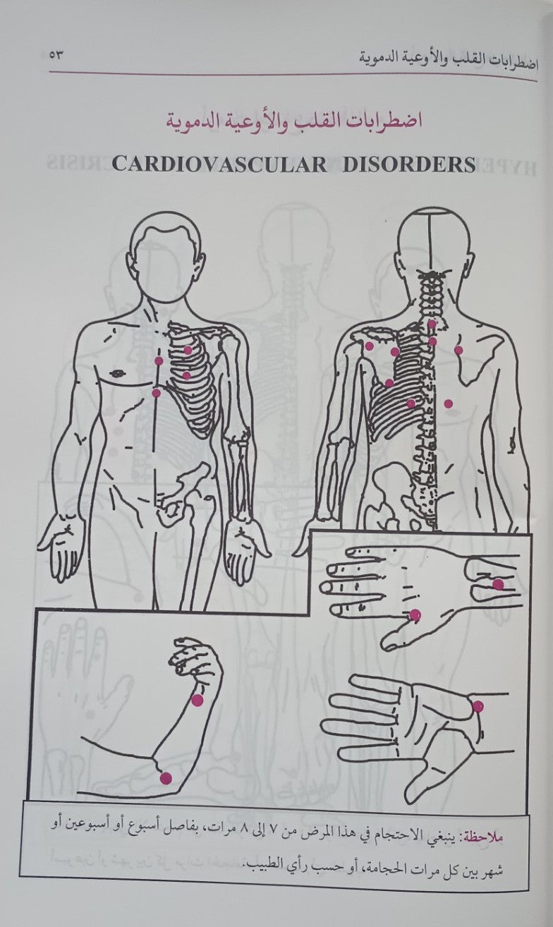 2 Copies of AL HIJAMA (Arabic) الحجامة # ABAHAC