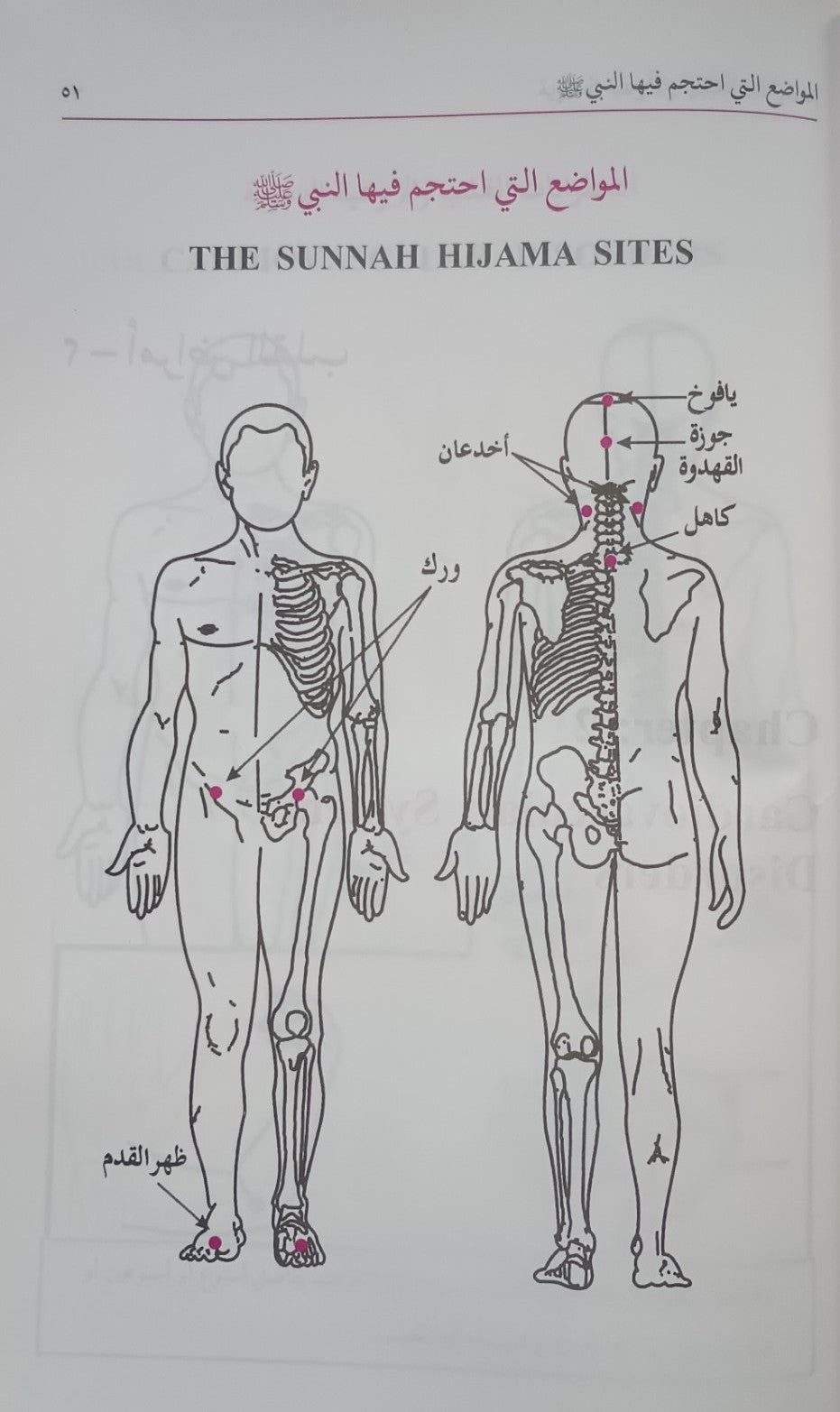 2 Copies of AL HIJAMA (Arabic) الحجامة # ABAHAC