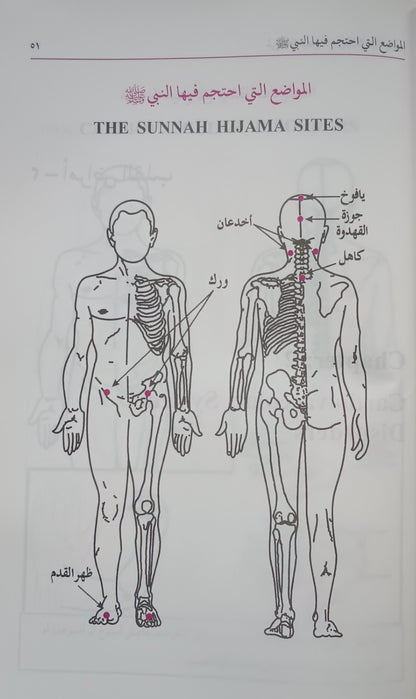 2 Copies of AL HIJAMA (Arabic) الحجامة # ABAHAC