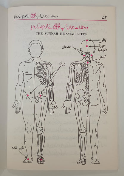 2 Copies of AL HIJAMA الحجامة (الأردية) # ABAHUA